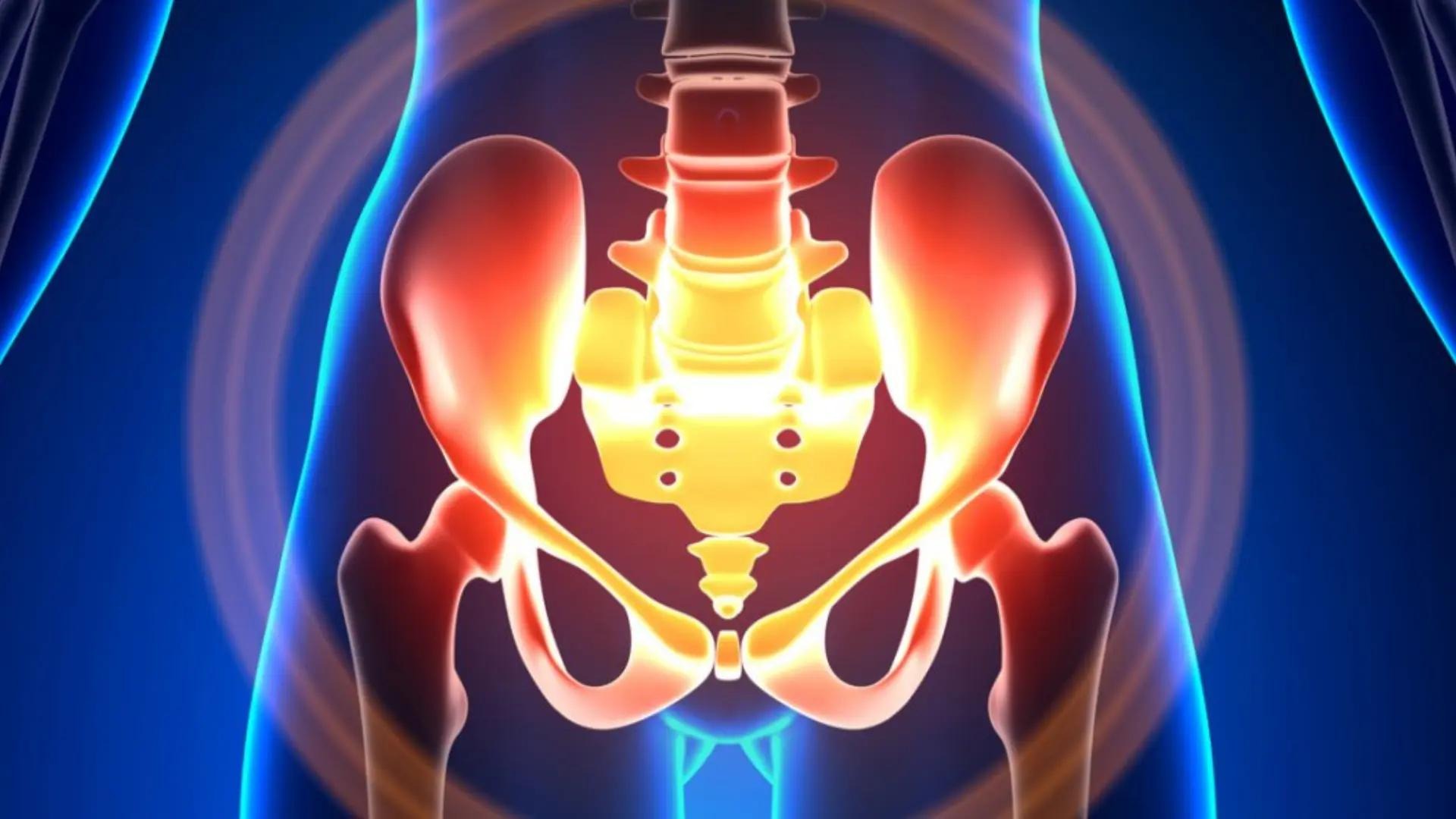 Pelvic Floor Dysfunction