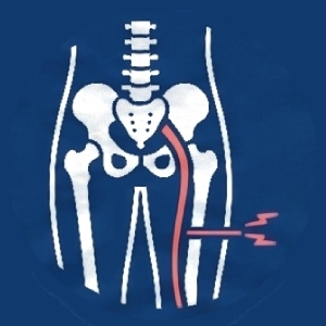 Icon of a person standing in a side profile with one arm bent forward, symbolizing chiropractic care. A mirrored outline of the person is shown behind them, slightly offset to the right, creating an impression of movement or pain relief. The background is light grey.